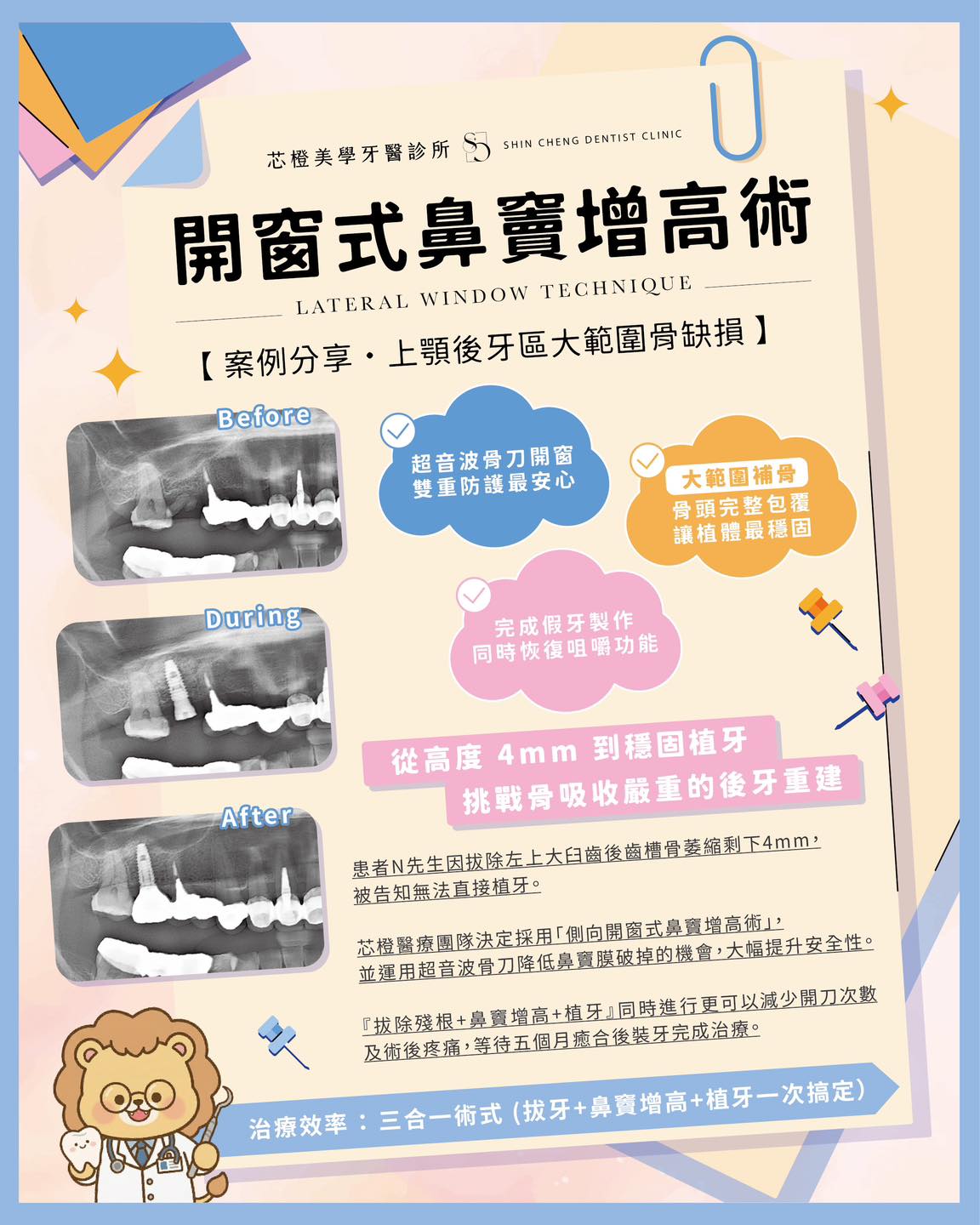 因拔除後牙等待多時,準備植牙時發現地基流失太嚴重,被告知無法直接植牙…|原站文章圖片