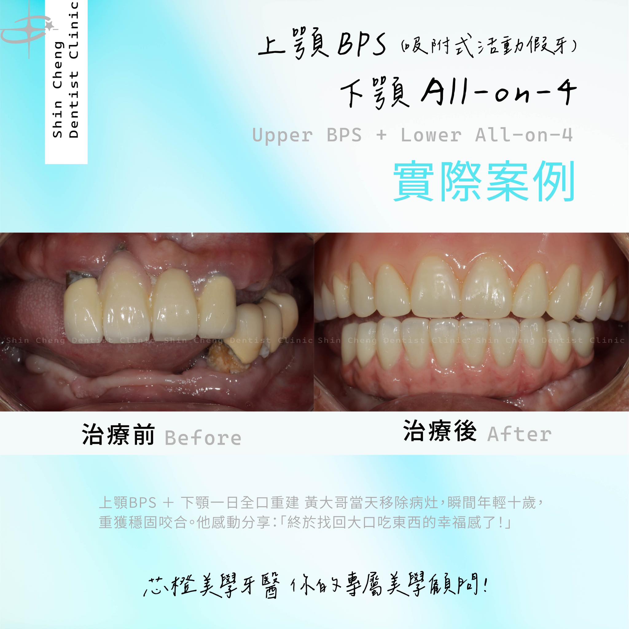 瞬間年輕十歲的秘密!黃大哥:「終於找回大口吃東西的幸福感了!」|原站文章圖片