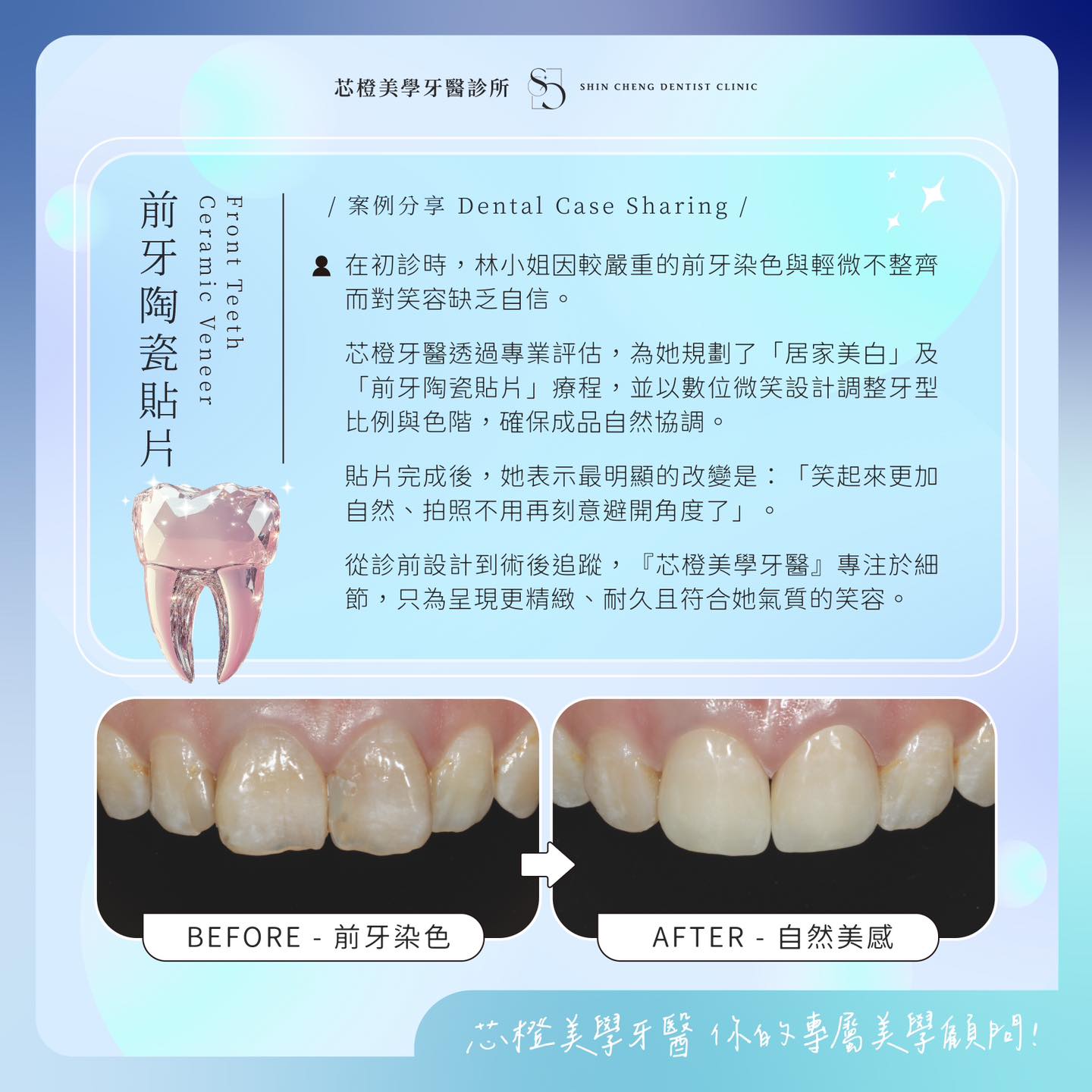 笑容，是你身上最昂貴的珠寶｜原站文章圖片