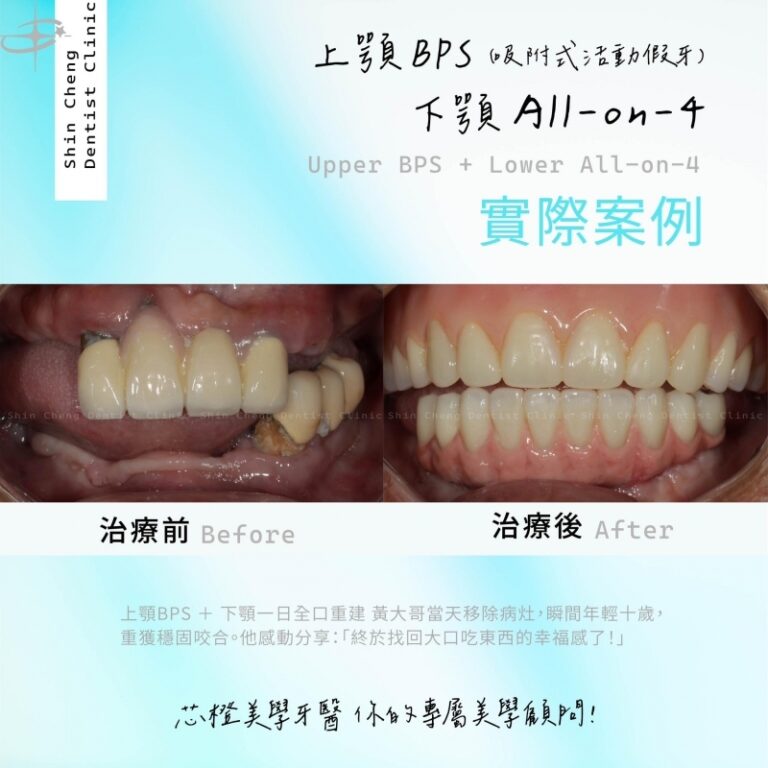 瞬間年輕十歲的秘密!黃大哥:「終於找回大口吃東西的幸福感了!」|文章封面