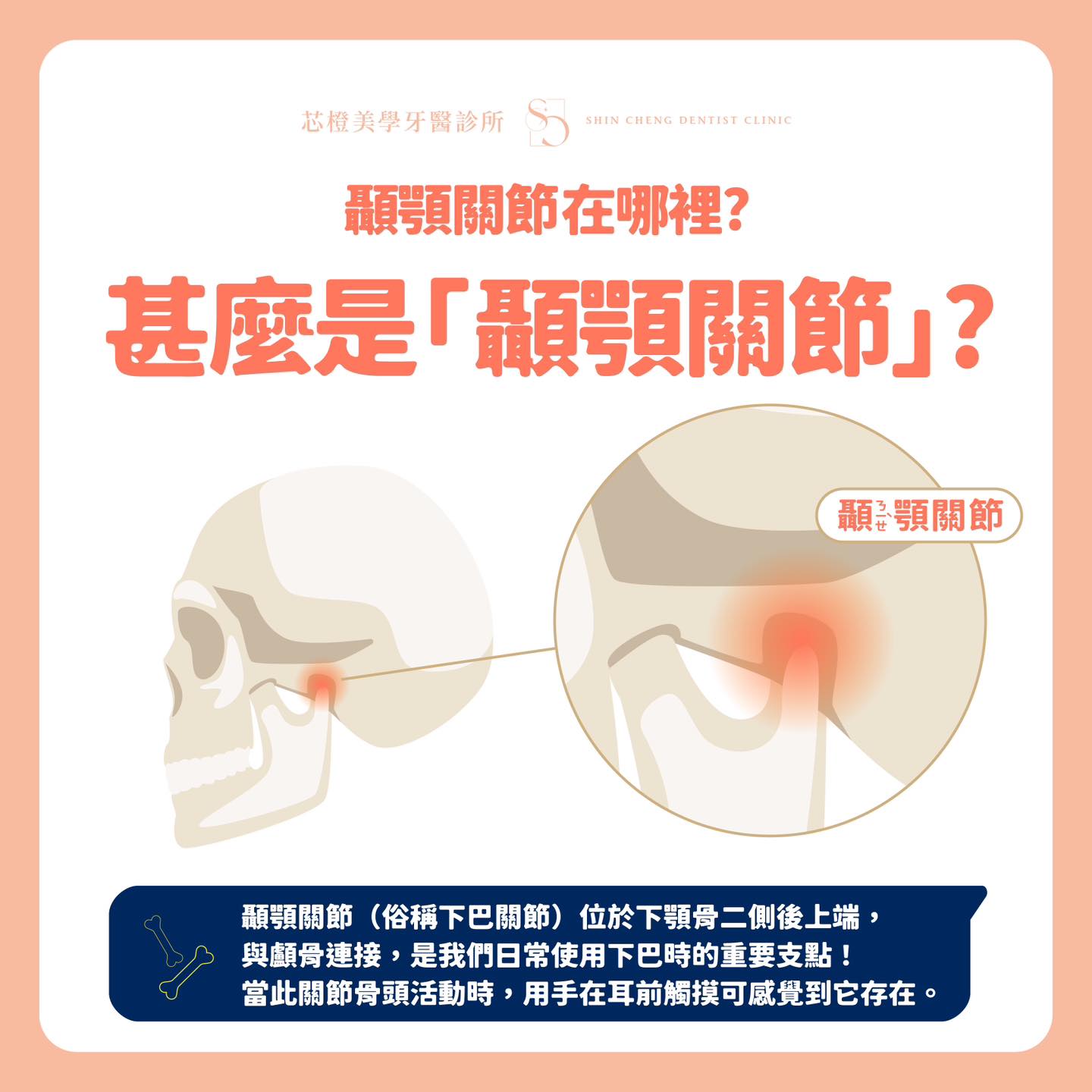『 臉部關節疼痛? 嘴巴張開更痛? 』|原站文章圖片