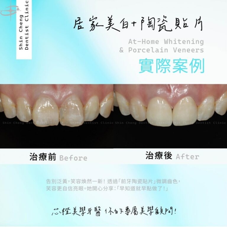 笑容自帶濾鏡!告別泛黃,這一次讓自信「亮」出來|文章封面