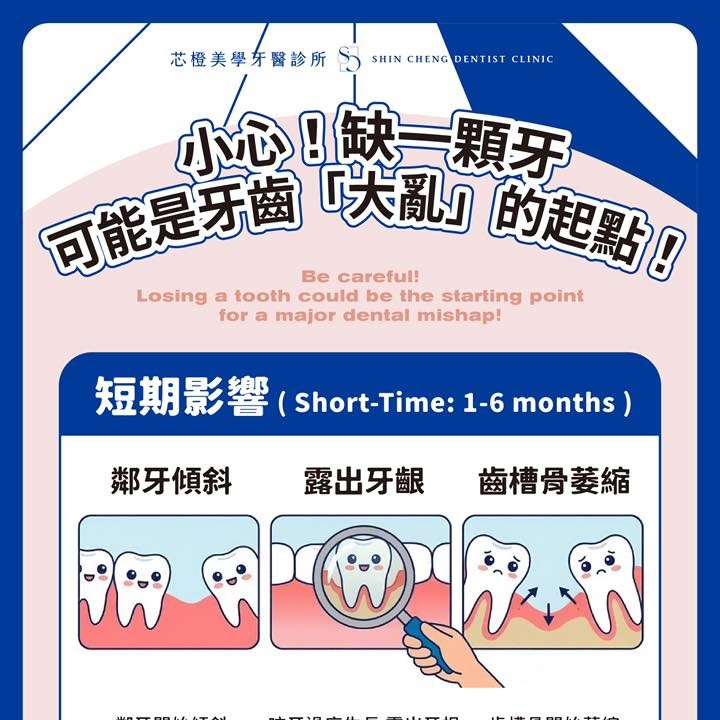 只是缺一顆牙,應該沒關係吧?|文章封面