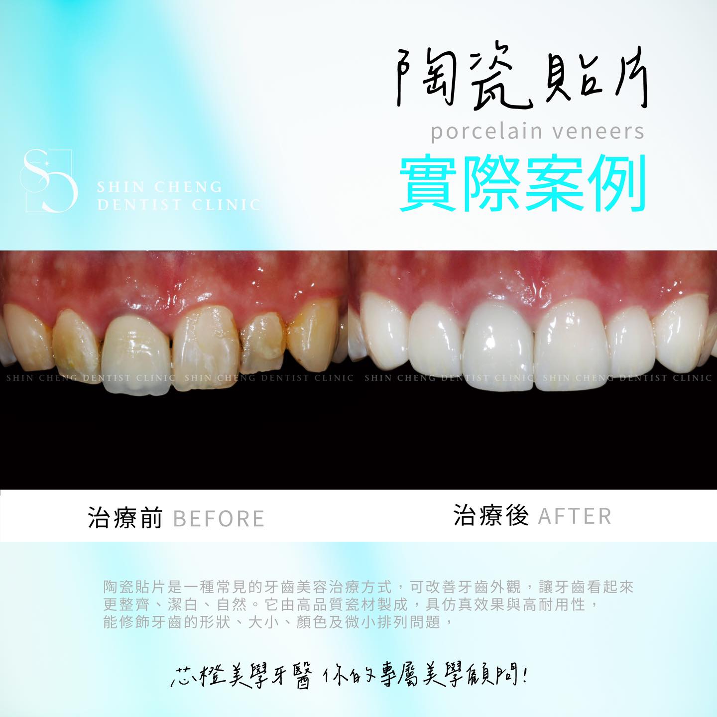 你知道嗎?理想中的笑容其實離你不遠喔!|原站文章圖片