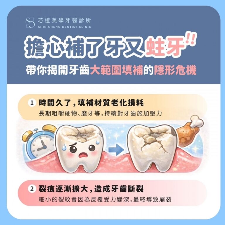 當牙齒補得越來越大,真的就比較安全嗎?其實大範圍填補,反而可能藏著你沒注意到的隱形危機|文章封面