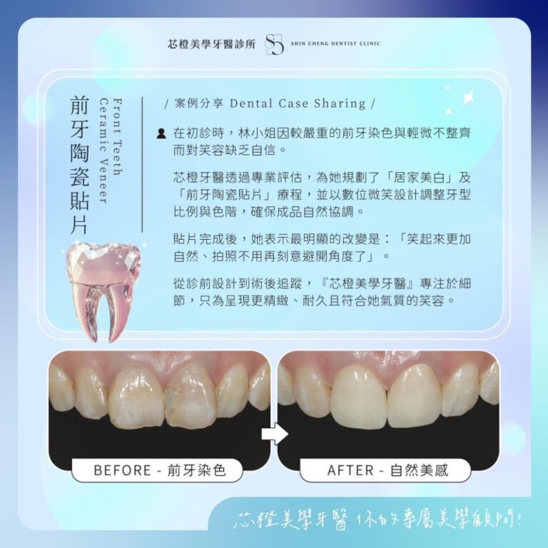 笑容,是你身上最昂貴的珠寶|文章封面