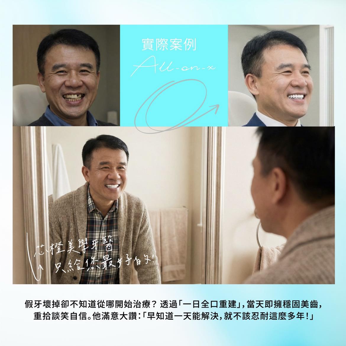 實際案例直擊！一日解決「嚴重缺牙」與「假牙損壞」｜原站文章圖片